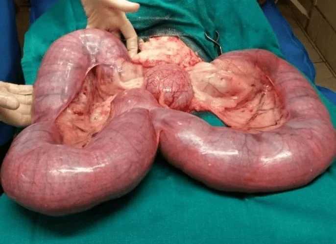 Pyometra Symptoms in Dogs: A Harsh Killer Amongst Female Dogs 5 Pyometra Symptoms in Dogs